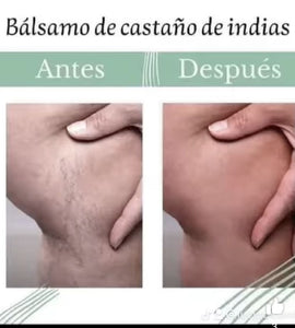 Gel De Castañas para Várices