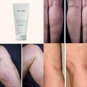 Gel De Castañas para Várices